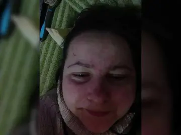 Bongacams Free Live Porn of Fox981