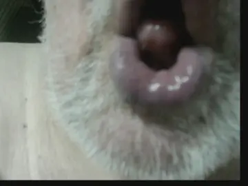 Cam4 Adult Video Chat of zahnlos